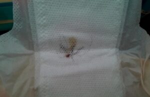 Nišlijka u ulošku pronašla komarca