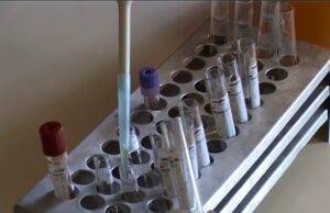 Stručnjaci kažu da AH1N1 ili tzv.“svinjski grip“ nije više tako opasan