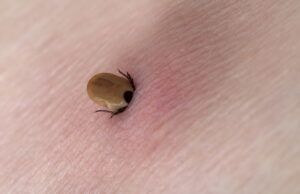 Veći broj građana tražio pomoć zbog ujeda krpelja