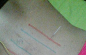 FIZIO LIFE –  život, alternativa uvek i zauvek