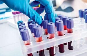 AKCIJA „OTVORENA VRATA SLUŽBE ZA LABORATORIJSKU DIJAGNOSTIKU“