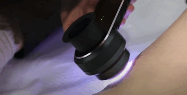 Besplatni pregledi kože