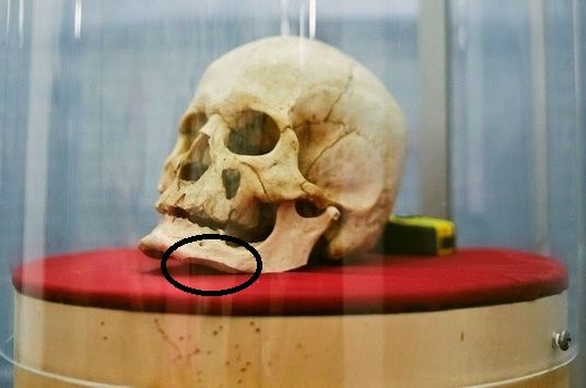 Lobanja koja je možda pripadala Stevanu Sinđeliću