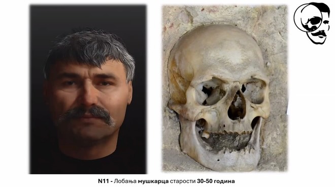 Lobanja starosti 30 - 50 godina