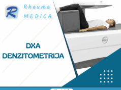 Poliklinika Rheuma Medica: DXA denzitometrija, zlatni standard za dijagnozu! Poliklinika Rheuma Medica