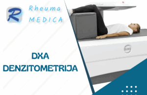 Poliklinika Rheuma Medica: DXA denzitometrija, zlatni standard za dijagnozu! Poliklinika Rheuma Medica