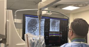 Novine u lečenju rezistentne hipertenzije – u UKC Niš prvi put urađena RDN procedura RDN intervencija