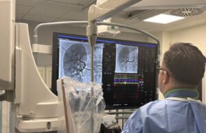 Novine u lečenju rezistentne hipertenzije – u UKC Niš prvi put urađena RDN procedura RDN intervencija