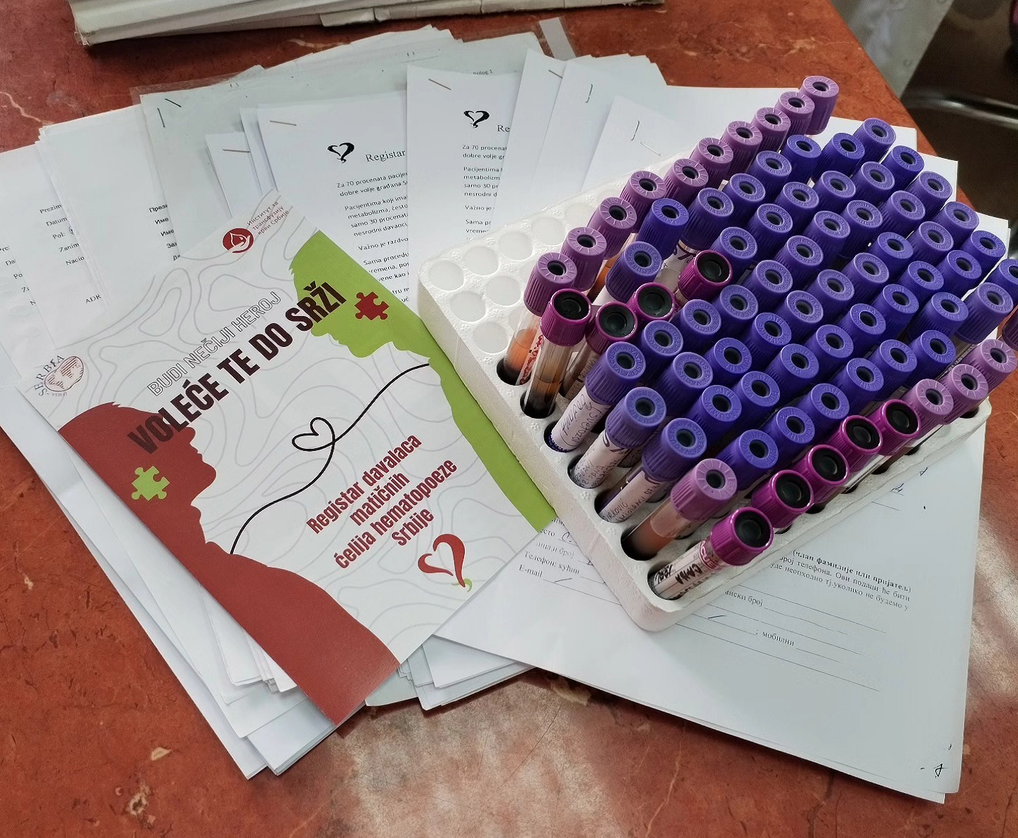 Traže se donori matičnih ćelija Traže se donori matičnih ćelija