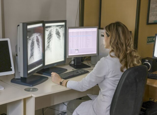 Skrining na karcinom pluća uz primenu low-dose skenera Skrining na karcinom pluća uz primenu low-dose skenera