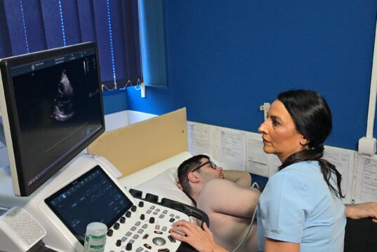 Besplatni pregledi srca najsavremenijim aparatom sa veštačkom inteligencijom u Institutu Niška Banja Besplatni pregledi srca Institut Niška Banja