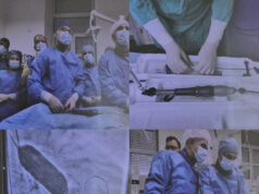 UKC Niš uveo TAVI proceduru: Urađene prve tri implantacije aortnog zaliska, pacijenti više ne moraju u Beograd ili Novi Sad