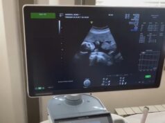 Novi ultrazvučni aparat za Ginekološku službu Doma zdravlja Niš Novi ultrazvučni aparat za Ginekološku službu