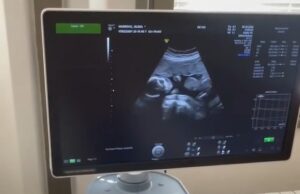 Novi ultrazvučni aparat za Ginekološku službu Doma zdravlja Niš Novi ultrazvučni aparat za Ginekološku službu